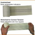 Aeroform Snake Bite Bandage