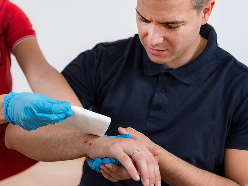 applying compression bandage snake bite